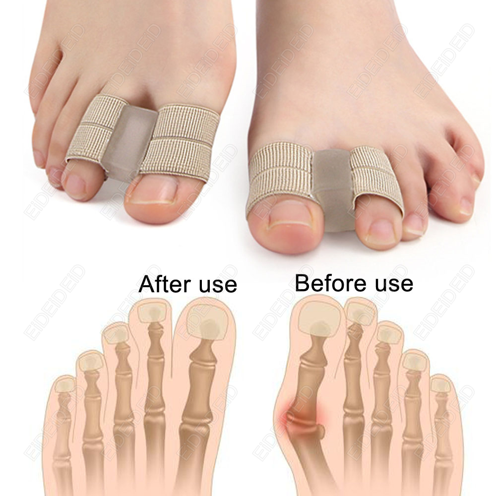 الورم تو مصحح تقويم العظام قدم - مراجعة Women'S Shoes For Bunions وسعره